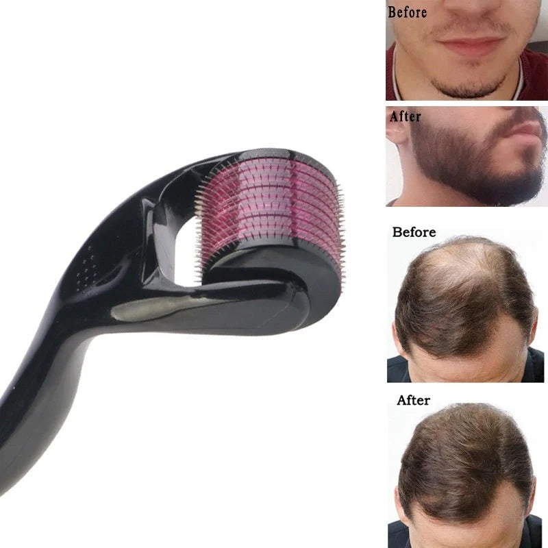 Derma Roller for Hair & Scalp Care